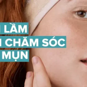 5 Lỗi Thường Gặp Khi Chăm Sóc Da Mụn