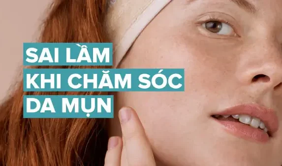5 Lỗi Thường Gặp Khi Chăm Sóc Da Mụn