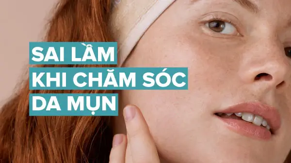 5 Lỗi Thường Gặp Khi Chăm Sóc Da Mụn