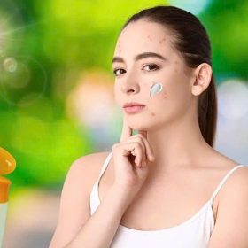 Top 8+ kem chống nắng an toàn cho da mụn