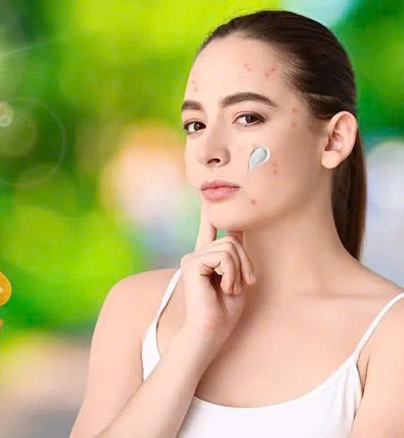 Top 8+ kem chống nắng an toàn cho da mụn