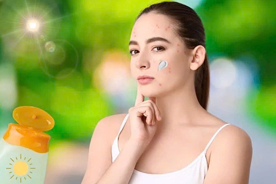 Top 8+ kem chống nắng an toàn cho da mụn